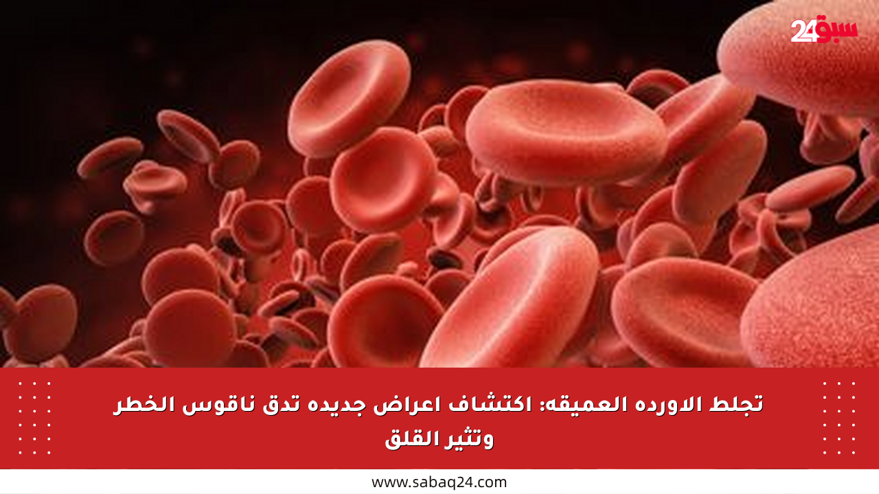 تجلط الأوردة العميقة: اكتشاف أعراض جديدة تدق ناقوس الخطر وتثير القلق